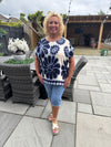 Bev Top